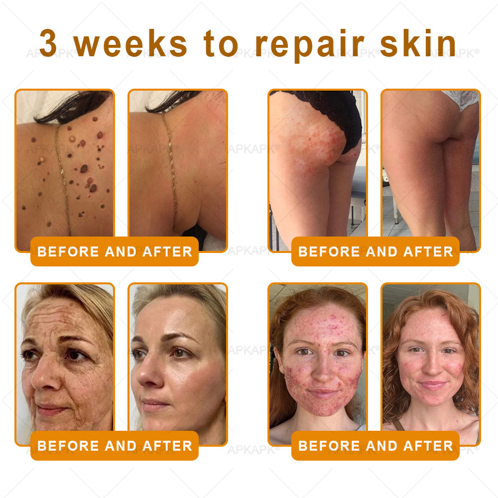 Made and Shipped from Australia 🐝 𝖠𝖯𝖪𝖠𝖯𝖪® 𝖡𝖾𝖾 𝗏𝖾𝗇𝗈𝗆 𝖲𝗄𝗂𝗇 𝖱𝖾𝗌𝗍𝗈𝗋𝖺𝗍𝗂𝗈𝗇 𝖢𝗋𝖾𝖺𝗆