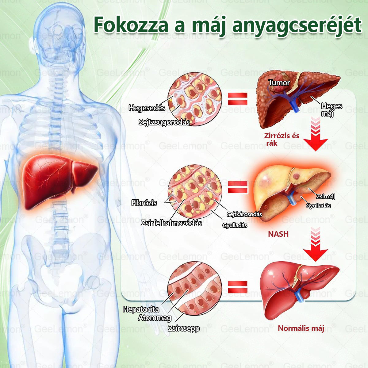 𝐆𝐞𝐞𝐋𝐞𝐦𝐨𝐧®🔥Glumasetide 8 az 1-ben Karcsúsító Nano Mikrotűs Tapasz 🇭🇺