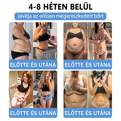 Magyar szakértők által ajánlott 🌿 FFBSI® anyagcsere-támogató karcsúsító nano mikro-tűs tapasz