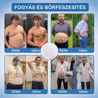 Magyar szakértők által ajánlott 🌿 FFBSI® anyagcsere-támogató karcsúsító nano mikro-tűs tapasz