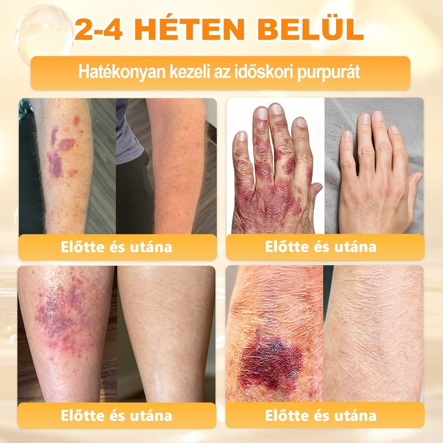 APKAPK® Méhméreges Bőrregeneráló & Feszesítő Krém– Prémium Anti-Aging Ápolás Érett és Érzékeny Bőrre