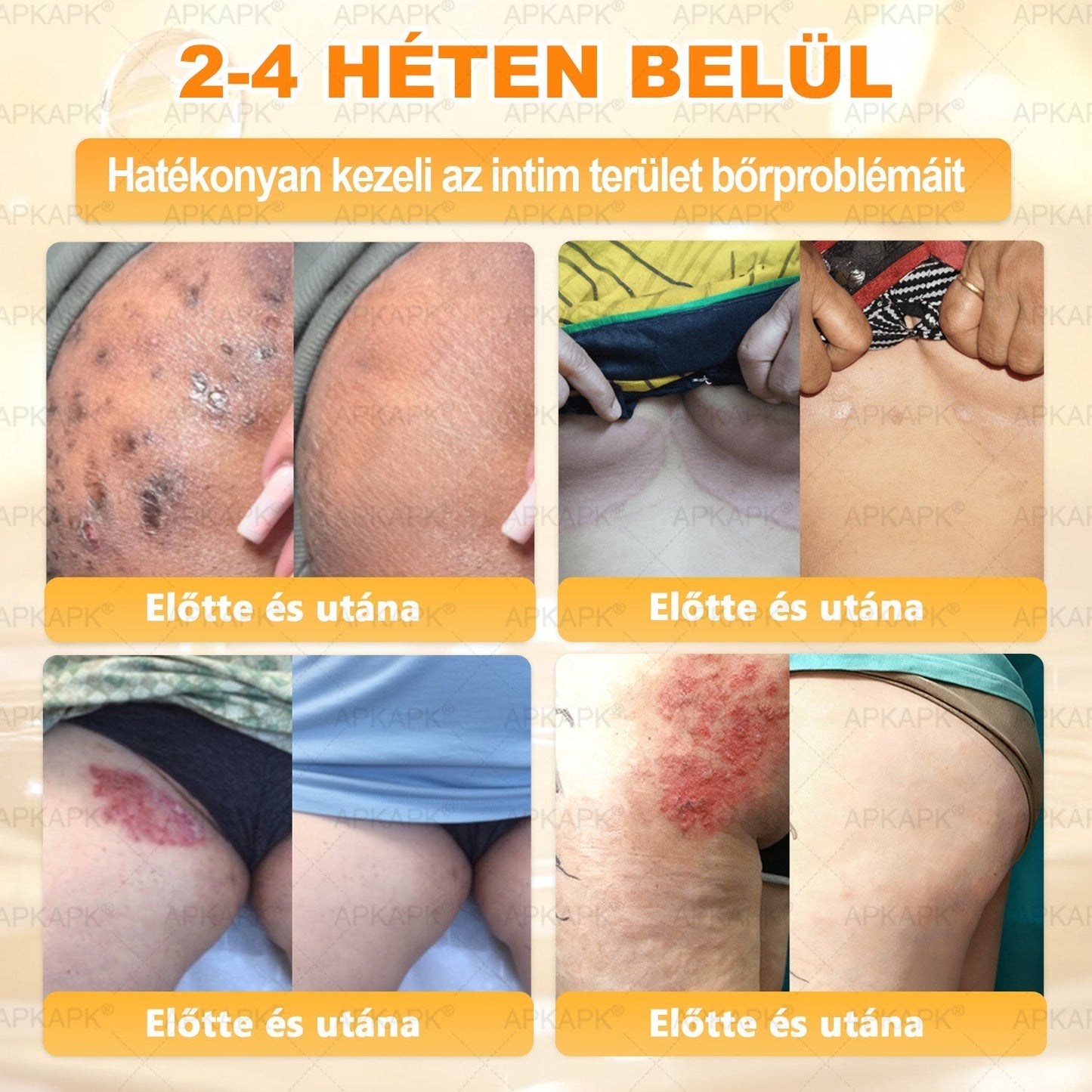 APKAPK® Méhméreges Bőrregeneráló & Feszesítő Krém– Prémium Anti-Aging Ápolás Érett és Érzékeny Bőrre