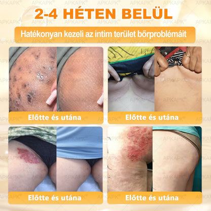 APKAPK® Méhméreges Bőrregeneráló & Feszesítő Krém– Prémium Anti-Aging Ápolás Érett és Érzékeny Bőrre