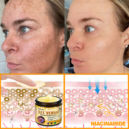 Made and Shipped from Australia 🐝 𝖠𝖯𝖪𝖠𝖯𝖪® 𝖡𝖾𝖾 𝗏𝖾𝗇𝗈𝗆 𝖲𝗄𝗂𝗇 𝖱𝖾𝗌𝗍𝗈𝗋𝖺𝗍𝗂𝗈𝗇 𝖢𝗋𝖾𝖺𝗆