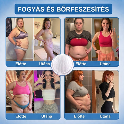 Magyar szakértők által ajánlott 🌿 FFBSI® anyagcsere-támogató karcsúsító nano mikro-tűs tapasz